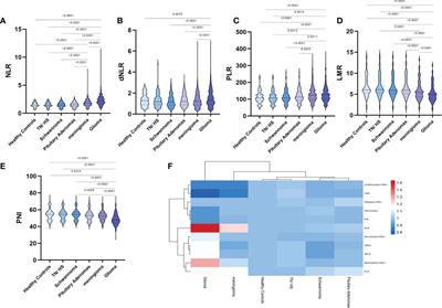 The role of preoperative inflammatory markers in patients with central nervous system tumors, focus on glioma